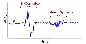 2단계 수면파인 K-complex와 수면방추(Sleep Spindle)의 뇌파 그래프